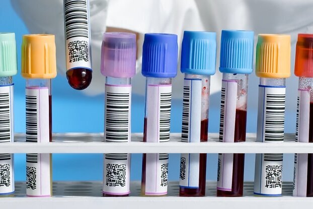 Several test tubes with barcode labels, in a tray, image design for round labeling, landscape format.